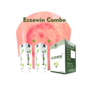 Anti Fungal Kit